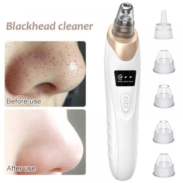 5-in-1 Electric Blackhead Remover & Pore Vacuum Cleaner