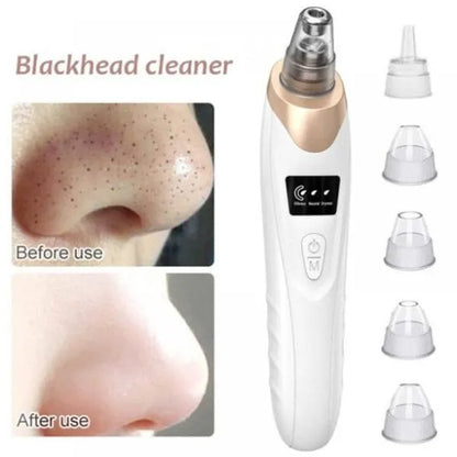 5-in-1 Electric Blackhead Remover & Pore Vacuum Cleaner
