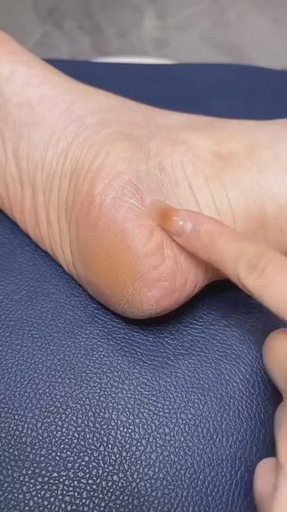 Professional Mani & Pedi Callus Remover