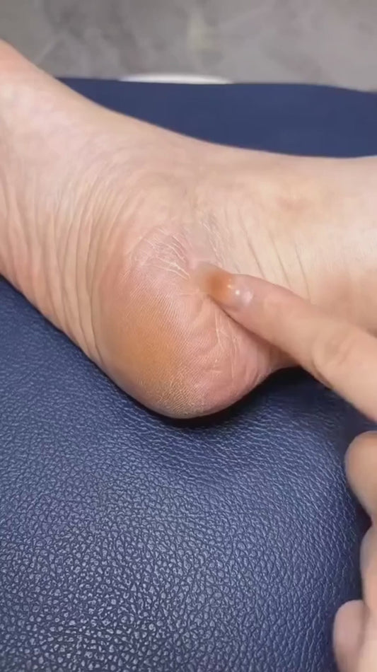 Professional Mani & Pedi Callus Remover